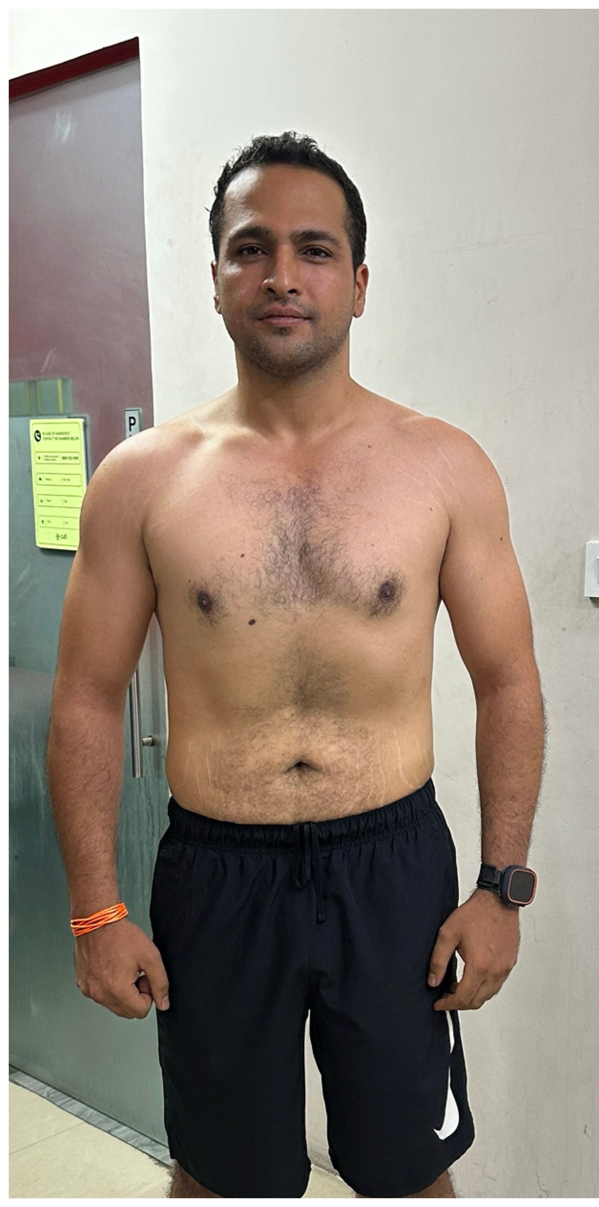 Kanishka after transformation