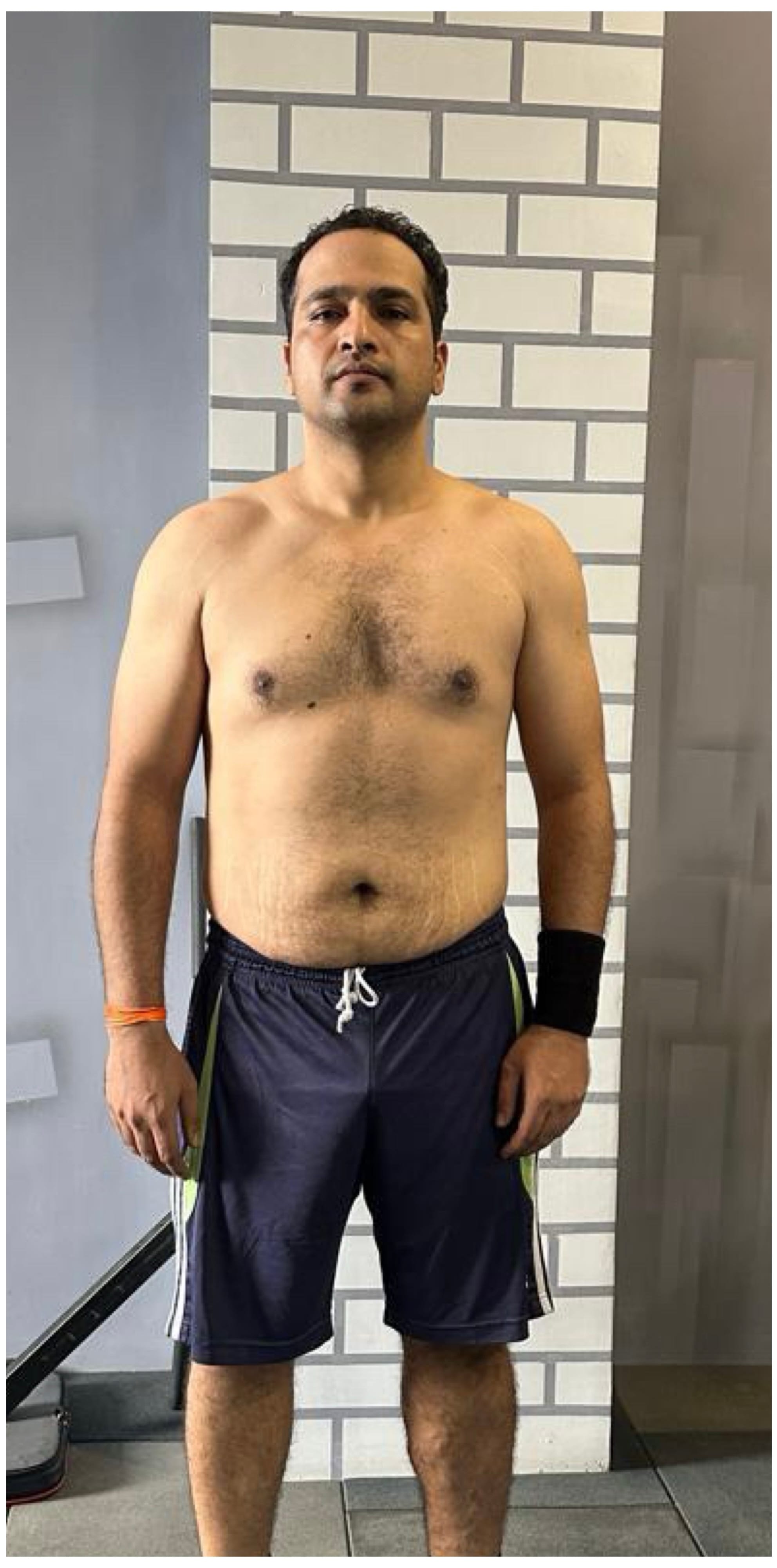 Kanishka before transformation